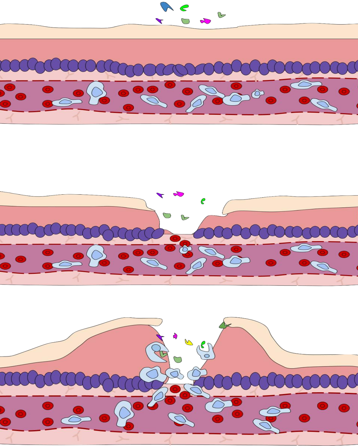 Diagram illustrating the immune response to a wound, showing bacteria and viruses entering a break in the skin, followed by white blood cells (phagocytes) migrating to the site of infection. The process depicts the initial breach, the entry of foreign organisms, and the subsequent cellular response to combat the infection.
