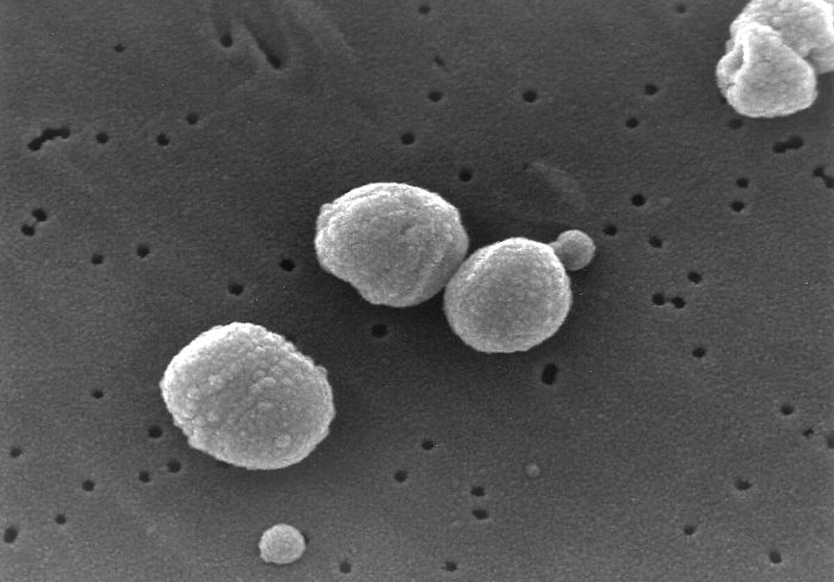 A scanning electron micrograph shows several spherical Streptococcus pneumoniae bacteria on a textured surface. The bacteria appear as irregular, roughly spherical shapes, some clustered together, with smaller pores visible on the background surface.