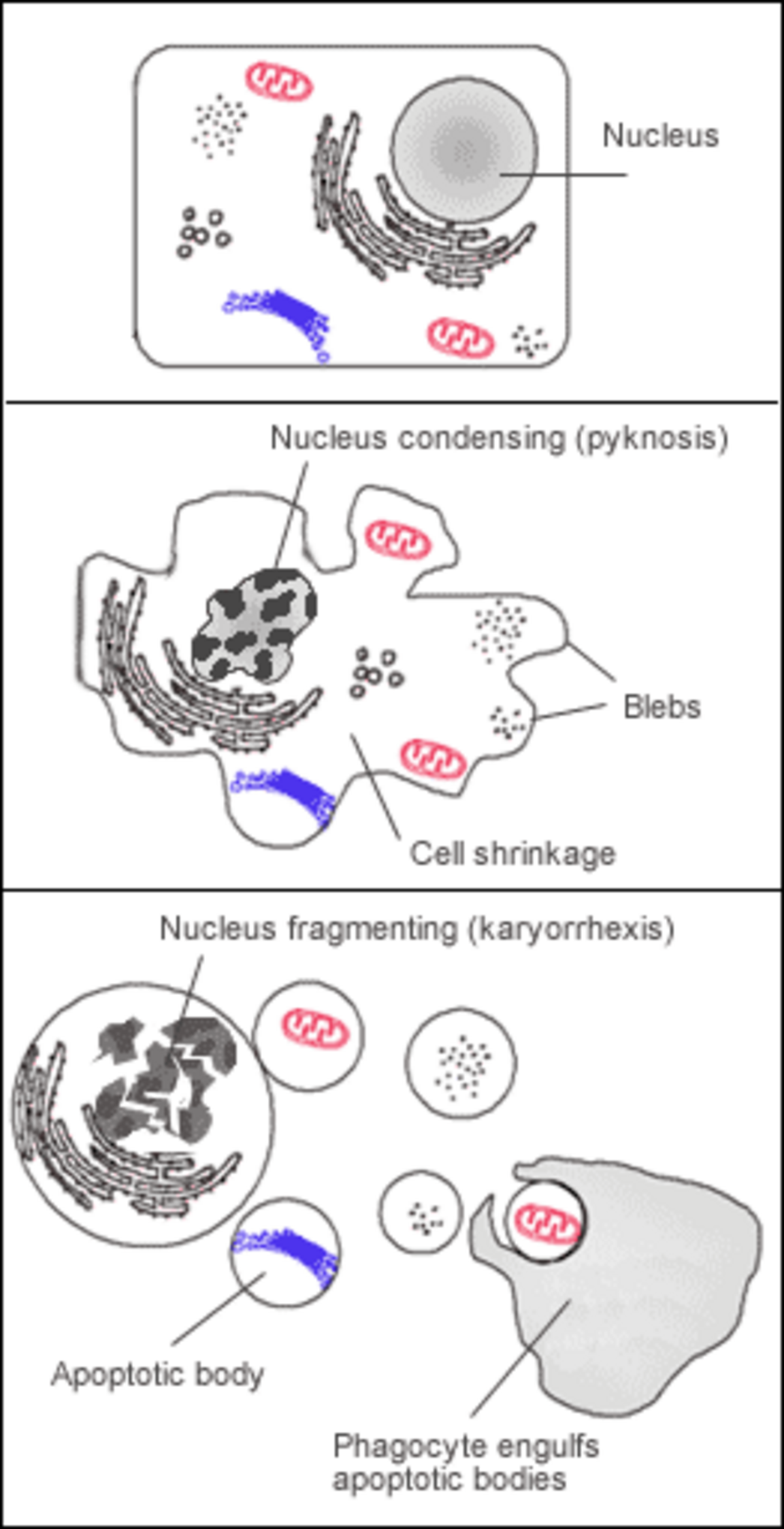 Diagram illustrating the process of apoptosis, or programmed cell death, in three stages. The first stage shows a normal cell with a nucleus, mitochondria, and endoplasmic reticulum; the second stage shows the nucleus condensing (pyknosis), cell shrinkage, and blebs forming; and the third stage shows the nucleus fragmenting (karyorrhexis), apoptotic bodies forming, and a phagocyte engulfing the apoptotic bodies.