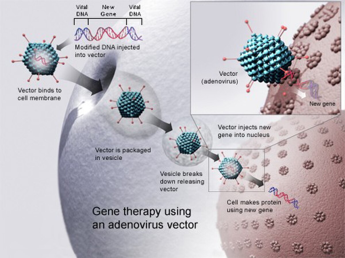 Diagram illustrating gene therapy using an adenovirus vector to introduce a new gene into a cell. The process shows viral DNA and a new gene being modified into a vector, which then binds to a cell membrane, is packaged in a vesicle, released, injects the new gene into the nucleus, and finally, the cell makes protein using the new gene.