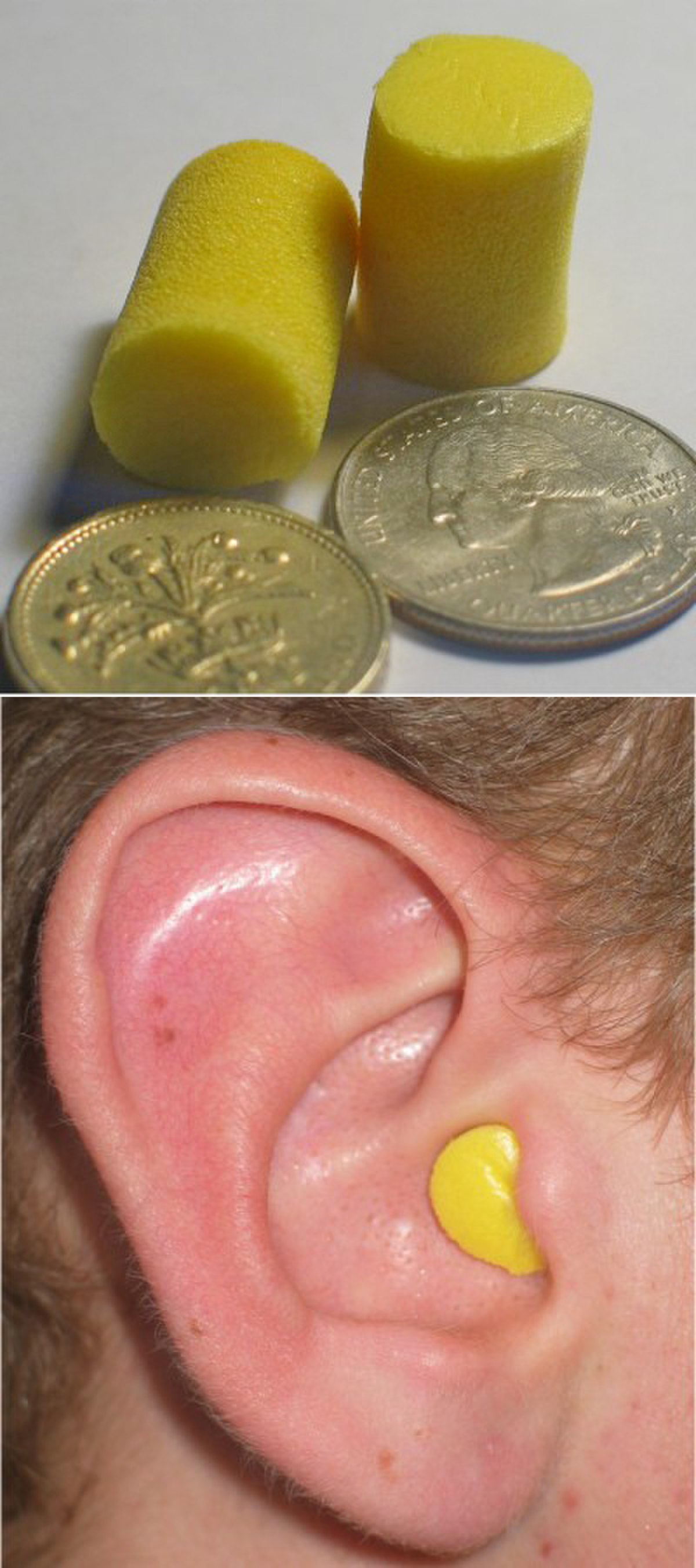 Two images of disposable foam earplugs: the top image shows two yellow earplugs next to a British 10 pence coin and a US quarter for scale, and the bottom image shows a yellow earplug inserted into a person's ear.