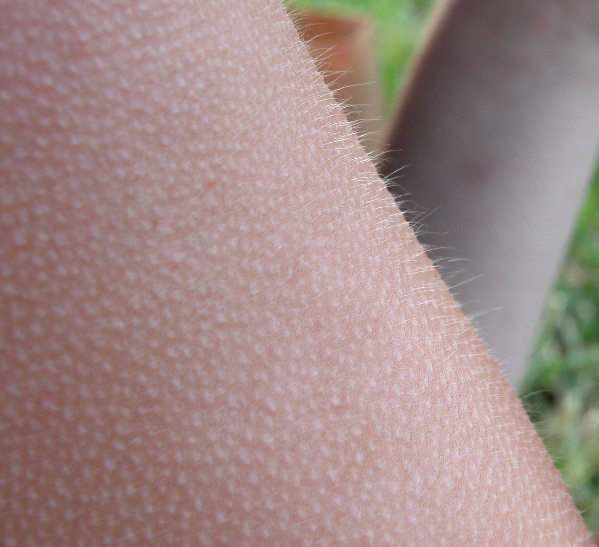 A close-up photograph of human skin exhibiting piloerection, commonly known as goose bumps. Small hairs are visibly standing erect on the surface of the skin.