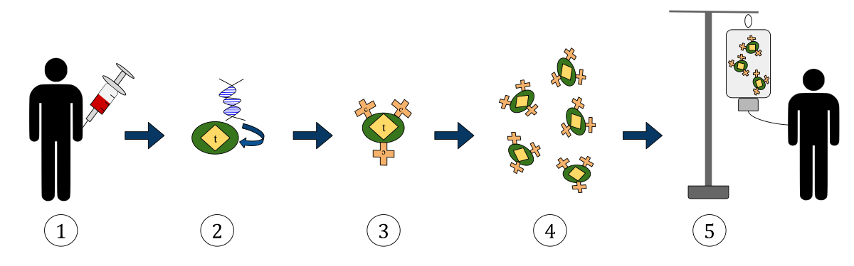 Diagram illustrating the CAR T-cell therapy process, from T-cell isolation to patient infusion. The five steps shown are: 1) T cells are isolated from a patient's blood, 2) a new gene encoding a chimeric antigen receptor is incorporated into the T cells, 3) engineered T cells are now specific to a desired target antigen, 4) engineered T cells are expanded in tissue culture, and 5) engineered T cells are infused back into the patient.