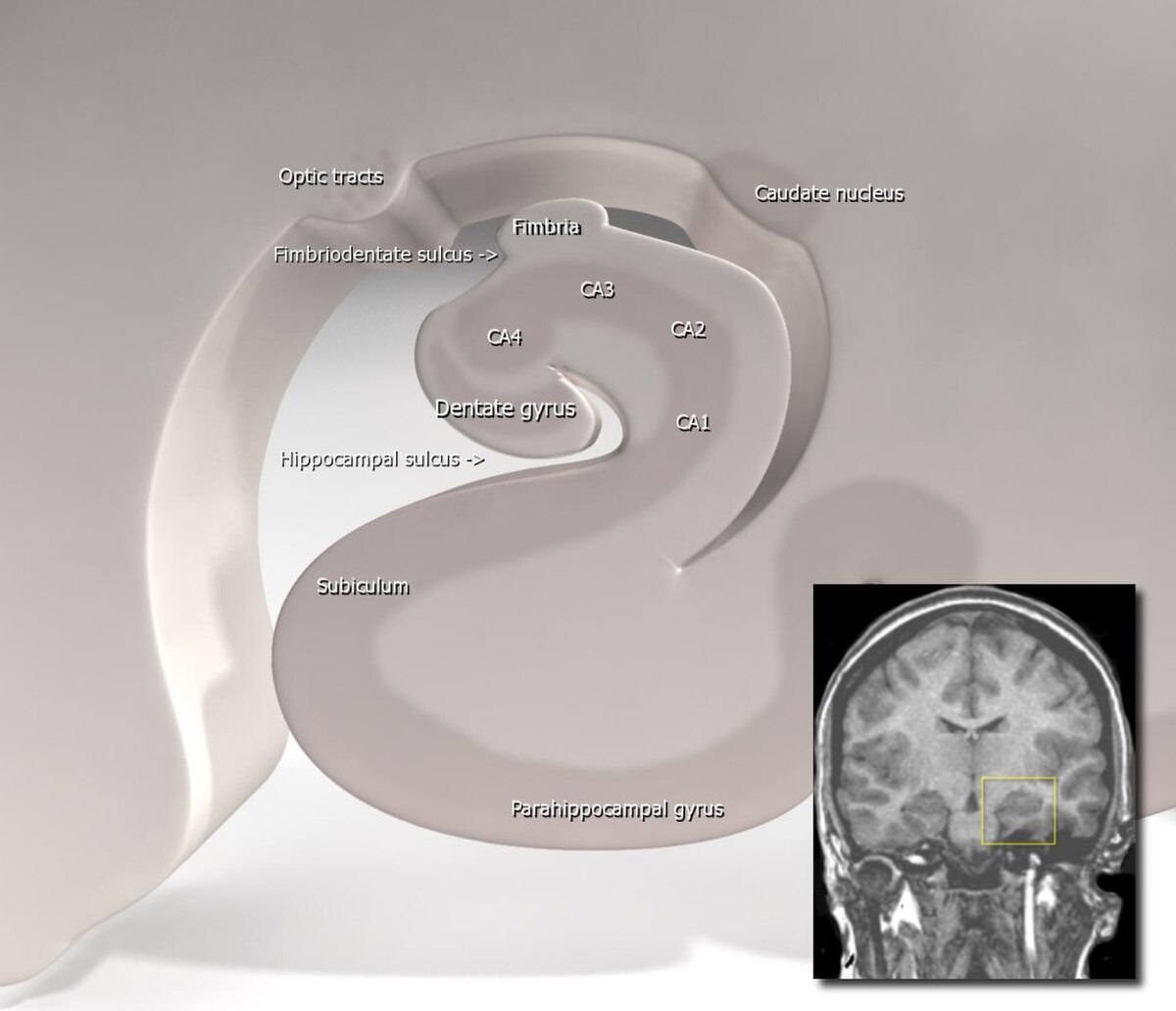 A 3D anatomical diagram of the hippocampus in the human brain, with various structures labeled including Optic tract, Fimbria, Fimbriodentate sulcus, Dentate gyrus, Hippocampal sulcus, Subiculum, Parahippocampal gyrus, and C-A1, C-A2, C-A3. An inset MRI scan shows the location of the hippocampus within the brain.