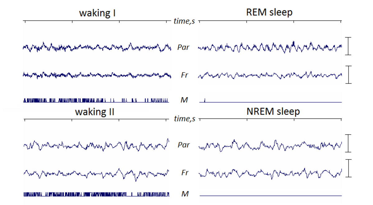 Electroencephalogram (EEG) recordings from a mouse showing different sleep-wake states: waking I, REM sleep, waking II, and NREM sleep. Each state displays distinct brain wave patterns, with REM sleep characterized by a prominent theta-rhythm, and each row is labeled Par, Fr, and M.