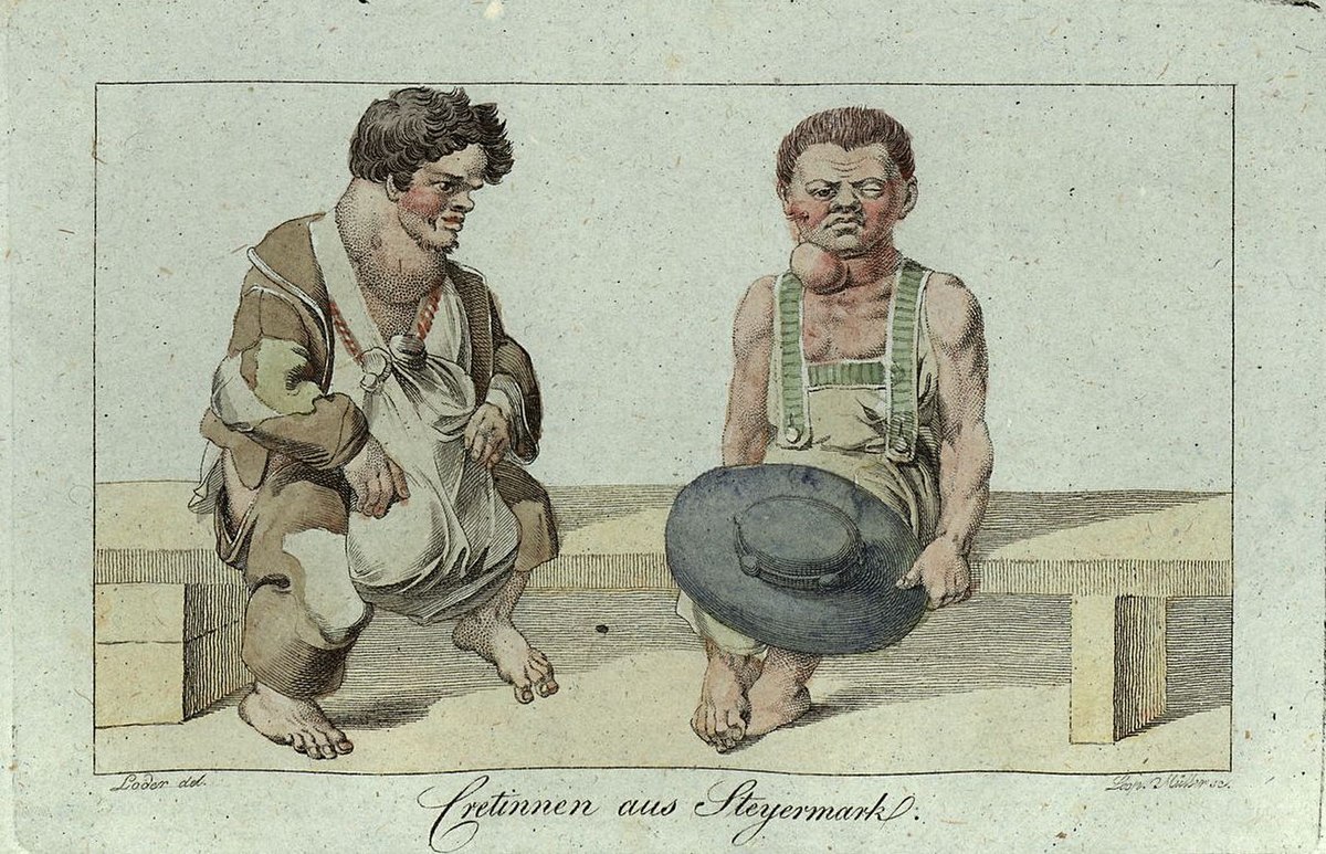 An 1815 copper engraving titled "Cretinnen aus Steyermark" (Cretins from Styria), depicting two men with visible goitres, seated on a bench, illustrating goitre and congenital iodine deficiency syndrome.