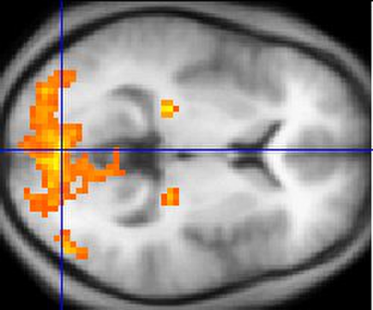A transverse segment fMRI scan of a human brain shows activated regions highlighted in orange. A blue crosshair indicates the center of the scan.