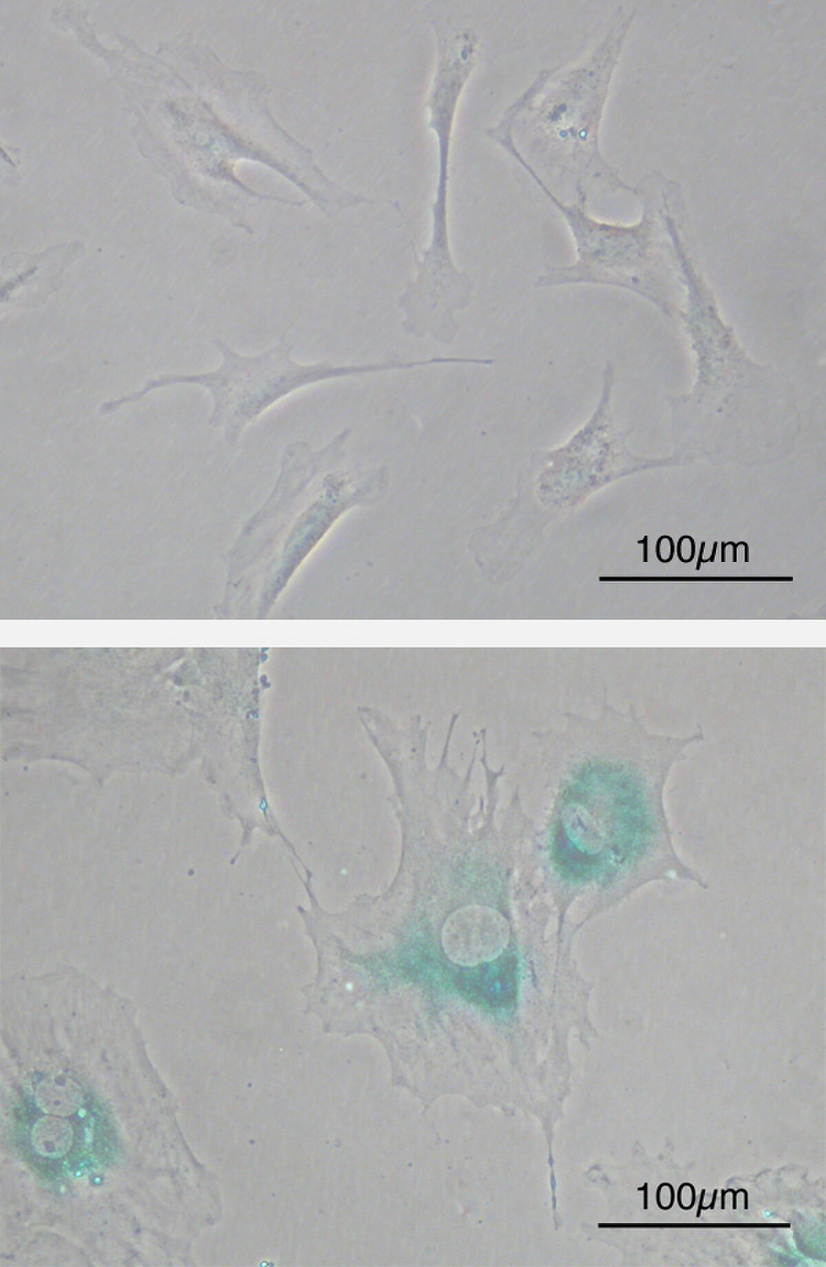 Micrographs showing primary mouse embryonic fibroblast cells (MEFs) before and after senescence, with a 100µm scale bar in each image. The top image displays spindle-shaped MEFs before senescence, while the bottom image shows larger, flattened senescent MEFs expressing senescence-associated β-galactosidase (SABG) as blue areas.