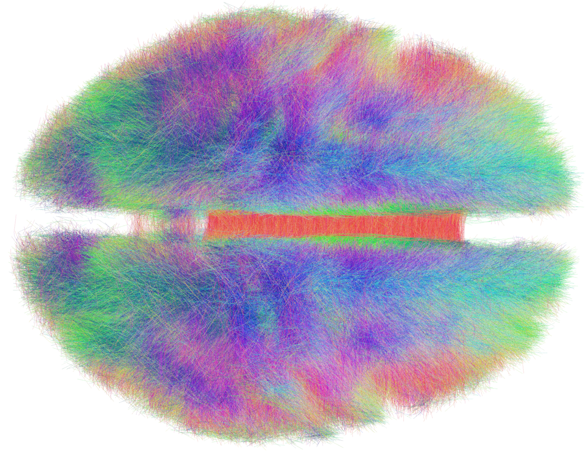 Rendering of a group connectome based on 20 subjects, showing anatomical fibers that constitute the white matter architecture of the human brain. The fibers are color-coded by traversing direction, with xyz-directions mapping to RGB colors respectively, and were visualized using TrackVis software.