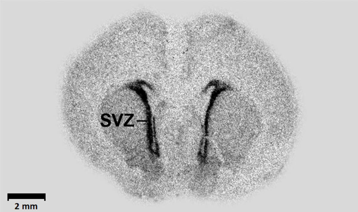 Autoradiography of a coronal brain section from a one-day-old Wistar rat, showing mRNA expression of the embryonic variant of the GABA-producing enzyme GAD67. The highest expression is visible in the subventricular zone (SVZ), indicated by a dark region, with a 2 mm scale bar at the bottom left.