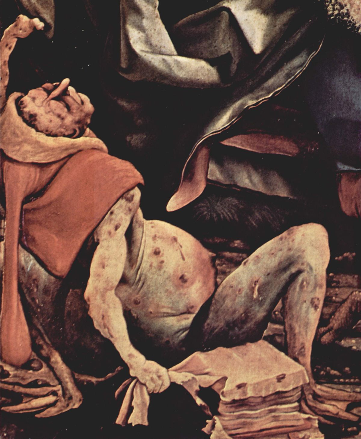A detail from Matthias Grünewald's painting "Temptation of St Anthony," depicting a patient with advanced ergotism. The figure shows signs of the disease, including discolored skin, swollen abdomen, and contorted limbs.