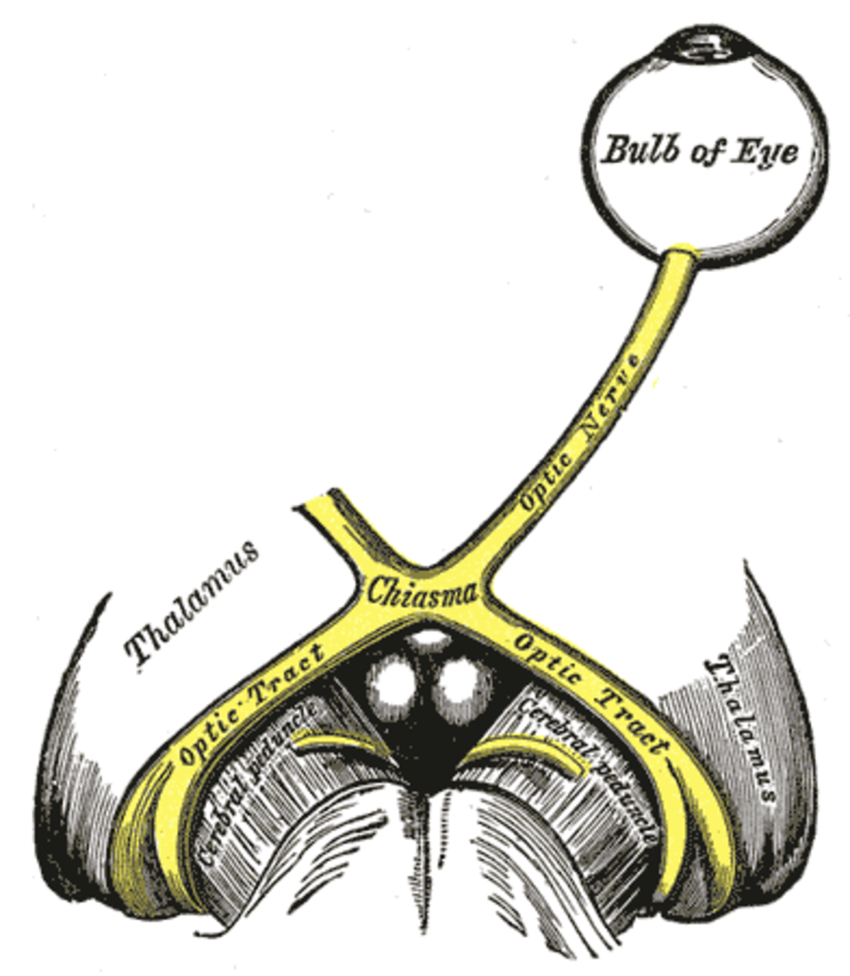 A diagram illustrating the optic chiasm and its connections to the eye and brain, with the optic chiasm, optic nerve, and optic tract highlighted in yellow. Labeled structures include the Bulb of Eye, Chiasma, Optic Nerve, Optic Tract, Thalamus, and Cerebral peduncle.