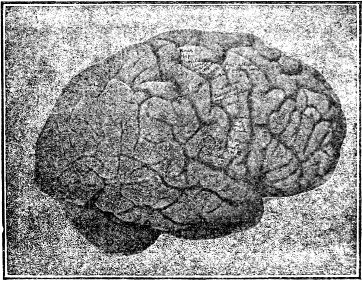 A grayscale image from 1907 depicts a human brain, showing its convoluted surface with gyri and sulci. The image has a grainy texture, typical of early photographic reproductions.