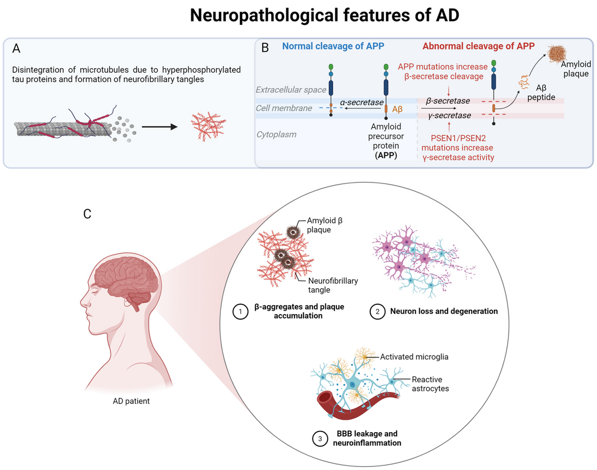 Diagram illustrating the neuropathological features of Alzheimer's disease (AD). Panel A shows the disintegration of microtubules due to hyperphosphorylated tau proteins and the formation of neurofibrillary tangles. Panel B compares normal cleavage of APP by α-secretase with abnormal cleavage by β-secretase and γ-secretase, leading to Aβ peptide and amyloid plaque formation, with PSEN1/PSEN2 mutations increasing γ-secretase activity. Panel C shows an AD patient's brain with magnified views of β-aggregates and plaque accumulation, neuron loss and degeneration, and BBB leakage and neuroinflammation involving activated microglia and reactive astrocytes.