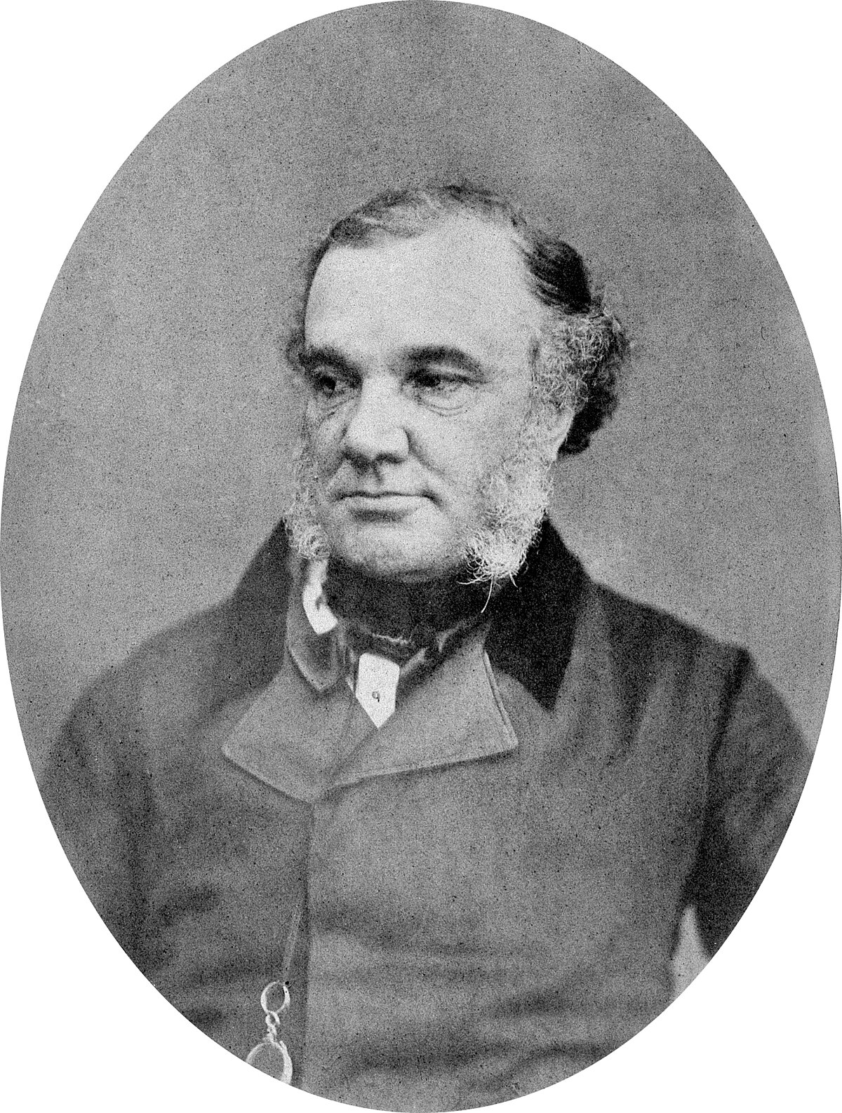 Portrait of Thomas Addison, a British physician known for his contributions to endocrinology. He is depicted in an oval frame, wearing a dark coat and a white shirt with a dark tie.