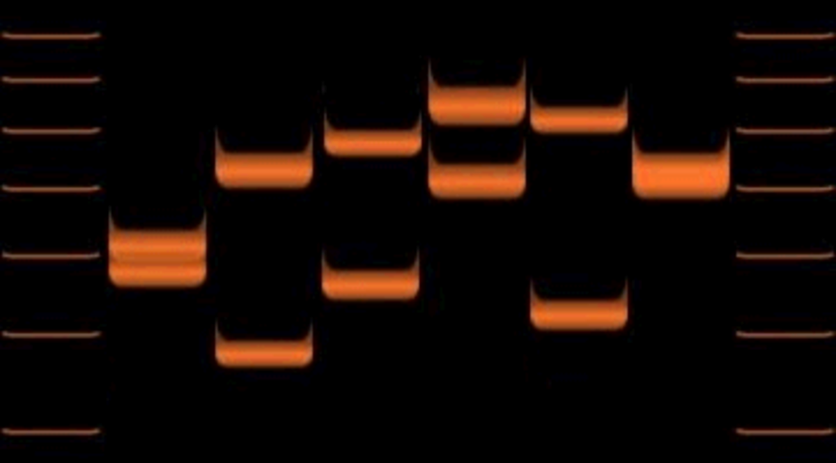 Gel electrophoresis results showing variations of VNTR allele lengths in six individuals. Orange fluorescent bands represent DNA fragments separated by size, flanked by ladder markers on the left and right columns.