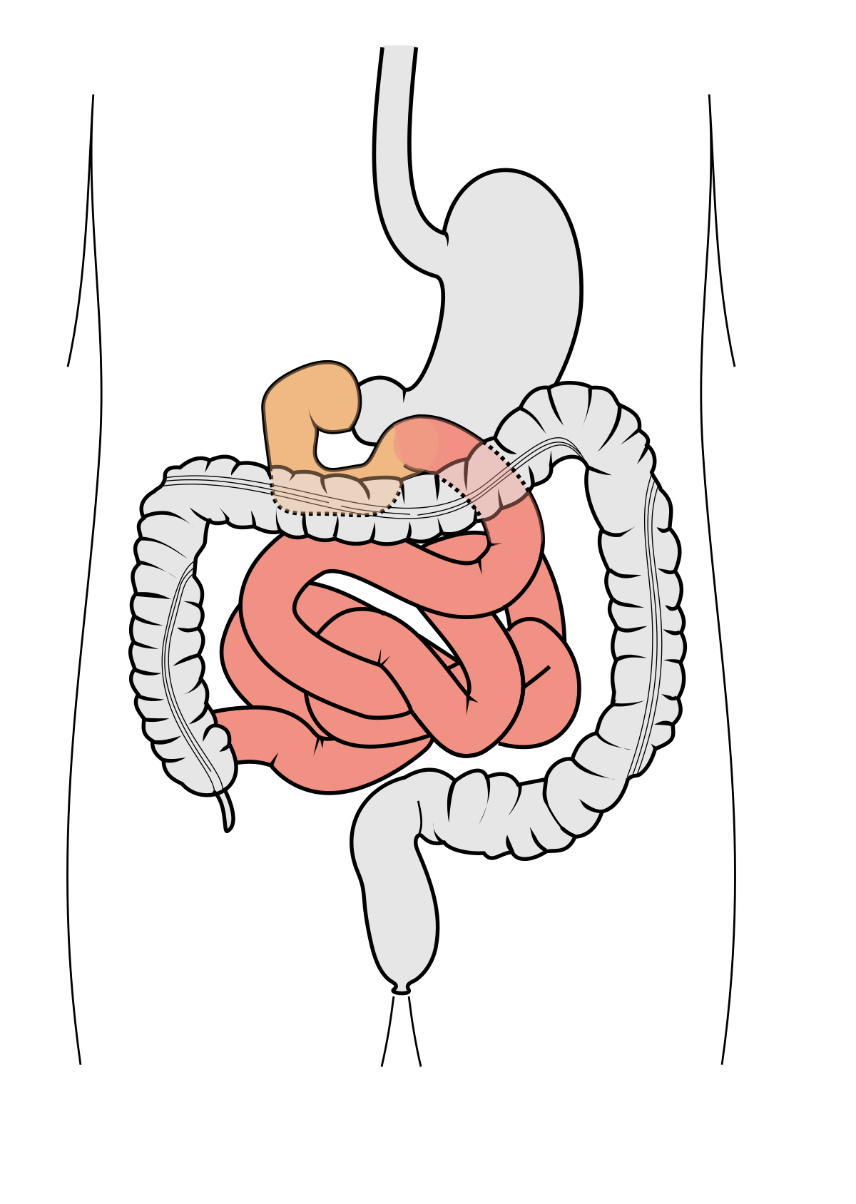 Diagram of the human digestive system focusing on the small intestine, highlighted in red, within the abdominal cavity. The stomach is shown at the top, the duodenum in orange, and the large intestine (colon) in gray surrounding the coiled small intestine.