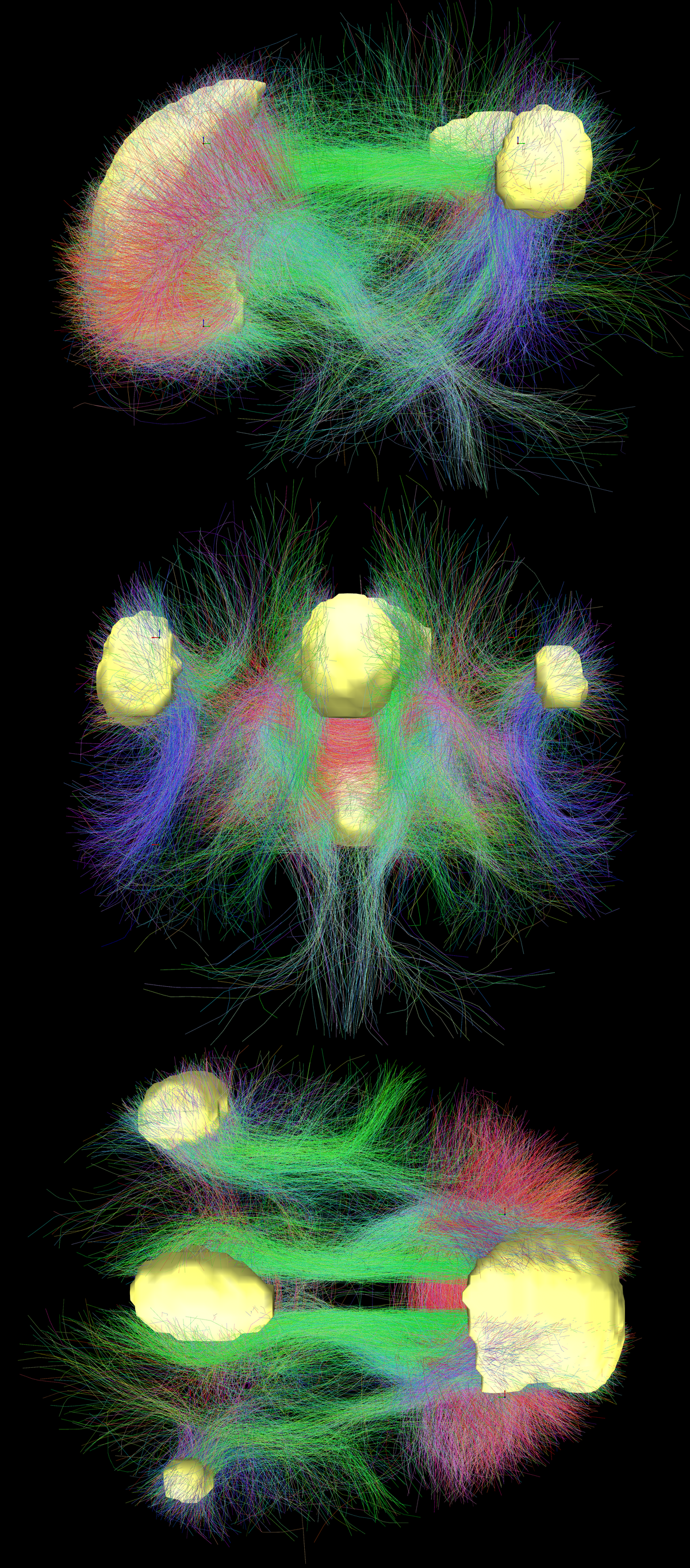 Three views (top, front, side) of the default mode network connectivity in the brain, showing main regions in yellow and connectivity between regions color-coded by structural traversing direction (xyz → rgb). The intricate network of neural pathways is visualized as colorful fibers connecting the yellow brain regions.