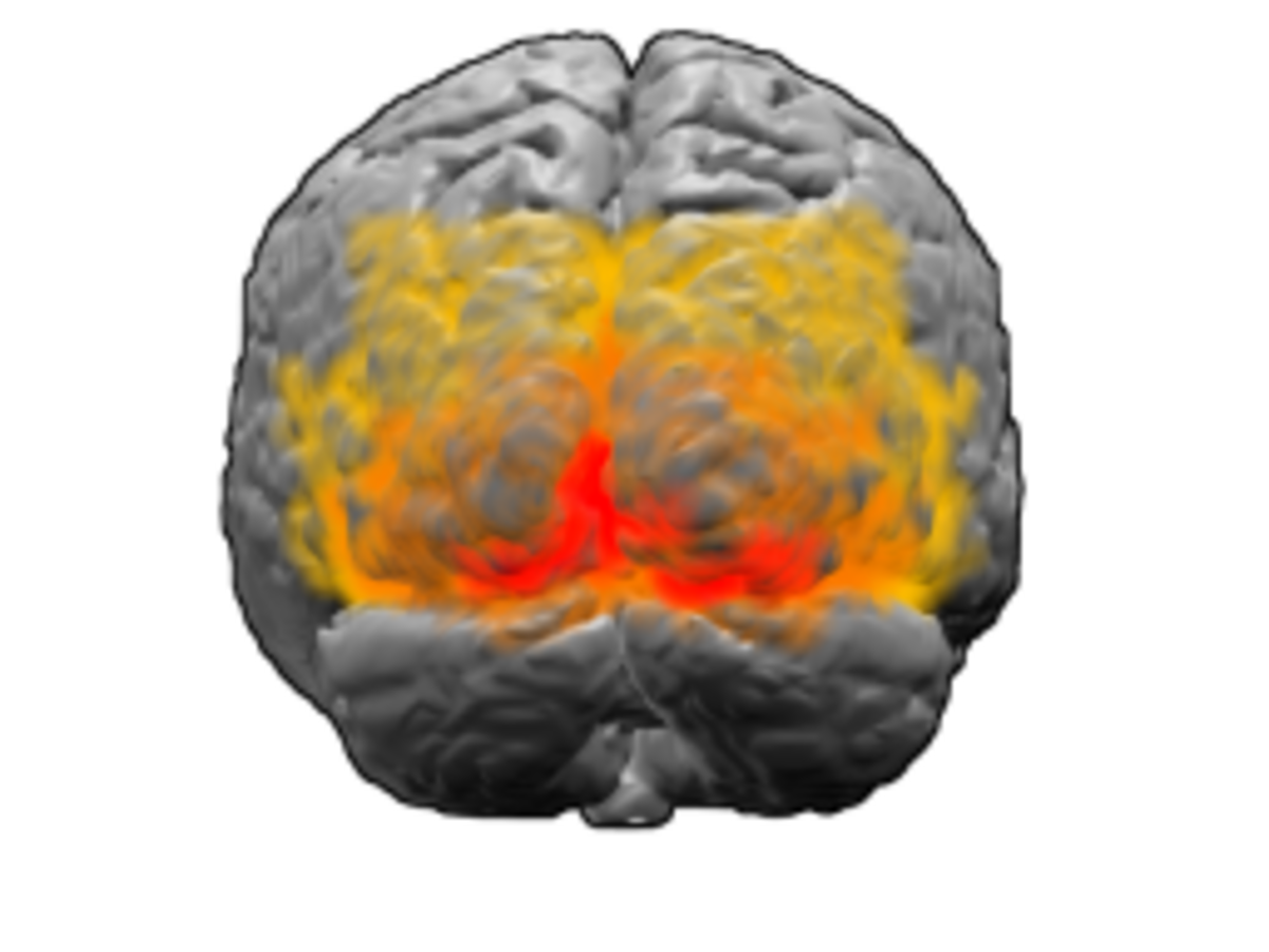 A 3D rendering of a human brain, viewed from the posterior, highlights the extrastriate cortex in shades of orange and red. This region, encompassing Brodmann areas 17, 18, and 19, is believed to be involved in perceptual priming.
