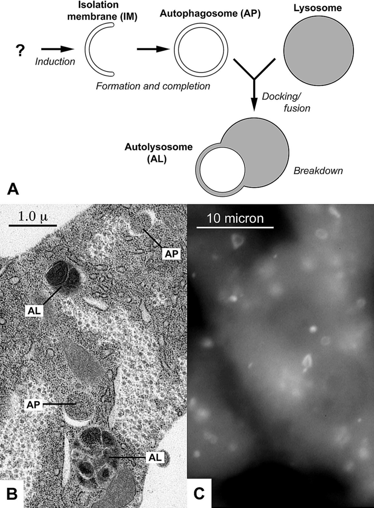 A multi-panel image illustrates the process of autophagy, showing a diagram (A), an electron micrograph (B), and a fluorescently labeled image (C). Diagram A shows the formation of an isolation membrane (IM) into an autophagosome (AP), which then fuses with a lysosome to form an autolysosome (AL) for breakdown. Panel B, an electron micrograph, shows autophagic structures AP and AL in the fat body of a fruit fly larva, with a scale bar of 1.0 µm. Panel C shows fluorescently labeled autophagosomes AP in liver cells of starved mice, with a scale bar of 10 micron.