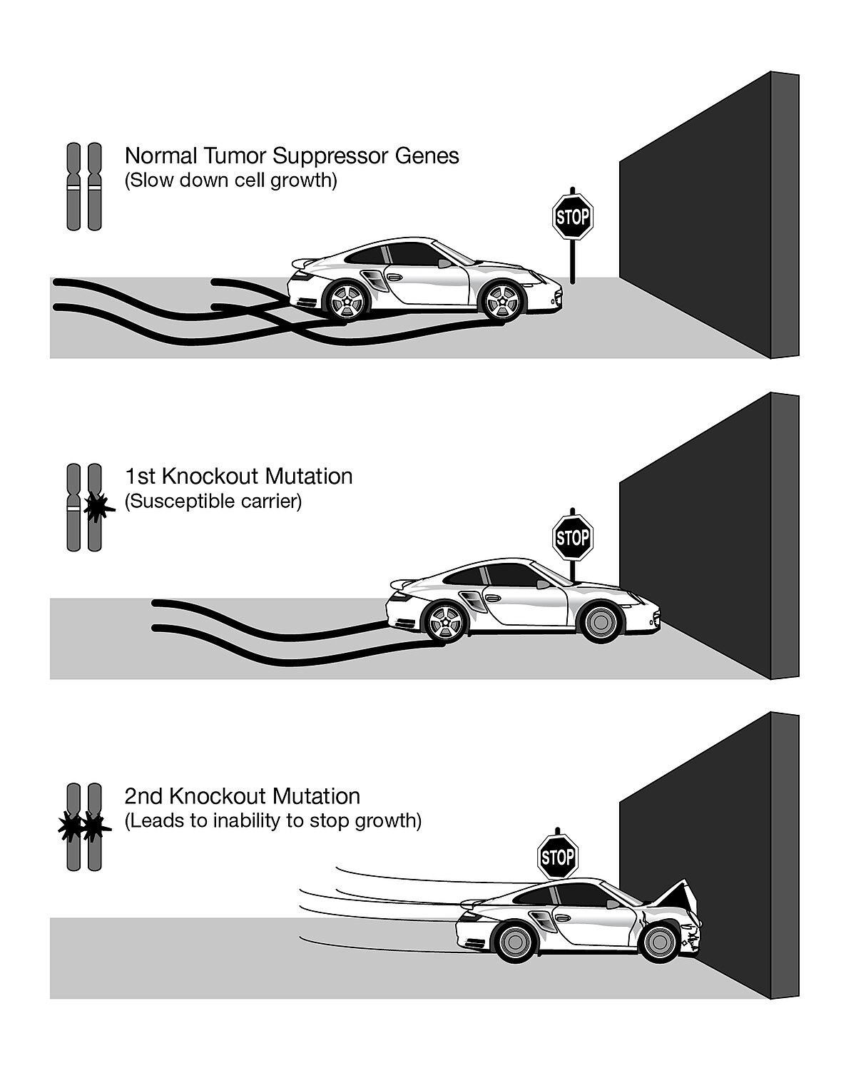 An illustration of the two-hit hypothesis for tumor suppressor genes, using a car and a wall analogy. The top panel shows "Normal Tumor Suppressor Genes (Slow down cell growth)" with a car approaching a stop sign before a wall; the middle panel shows "1st Knockout Mutation (Susceptible carrier)" with the car still able to stop; and the bottom panel shows "2nd Knockout Mutation (Leads to inability to stop growth)" with the car crashing into the wall.