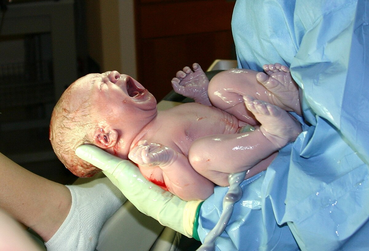 A newborn baby is shown crying immediately after birth, being held by medical personnel in blue scrubs and green gloves. The umbilical cord is still visible.
