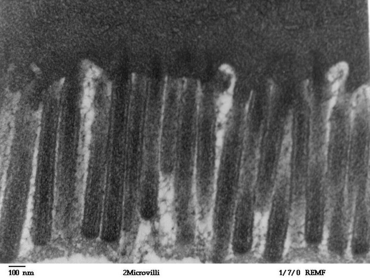 A Transmission Electron Micrograph (TEM) shows the microvilli lining the human jejunum, appearing as numerous finger-like projections. A scale bar indicates 100 nm.