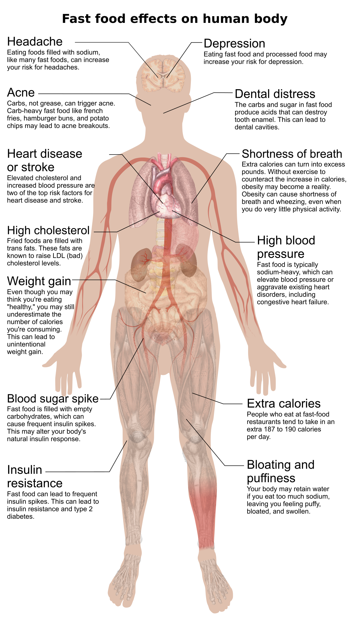 Diagram illustrating the effects of fast food, a common ultra-processed food, on the human body. Effects include headaches, depression, acne, dental distress, heart disease or stroke, shortness of breath, high cholesterol, high blood pressure, weight gain, blood sugar spike, extra calories, insulin resistance, and bloating and puffiness.