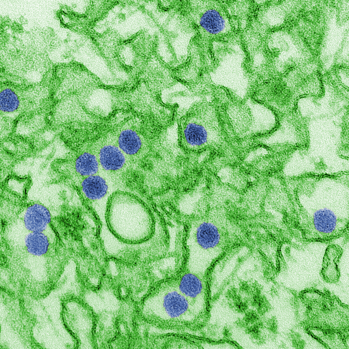 Electron micrograph showing multiple blue-colored Zika virus particles within a green cellular matrix, highlighting the virus's spherical shape and size relative to cellular components.